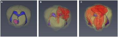 Magnetic resonance imaging prognostic factors for survival and relapse in dogs with meningoencephalitis of unknown origin